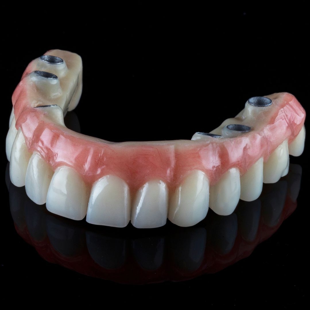 Implant Prosthetics
